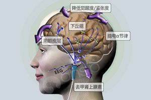 小孩做经颅磁有效果吗