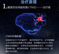 家用经颅磁刺激仪价格