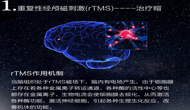 经颅磁刺激仪有效吗