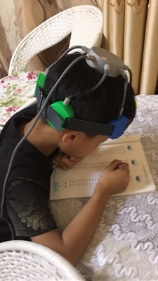 经颅磁刺激仪有用吗